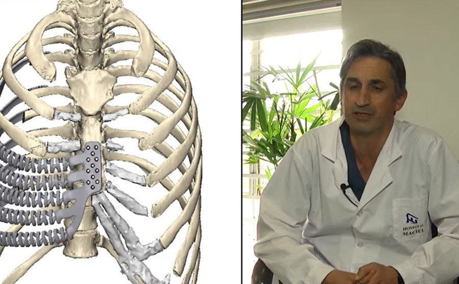 Inédita intervención torácica en el Hospital Maciel